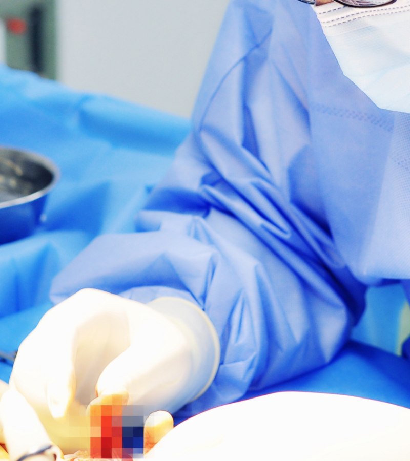 Chirurgia delle fratture vertebrali a Torino